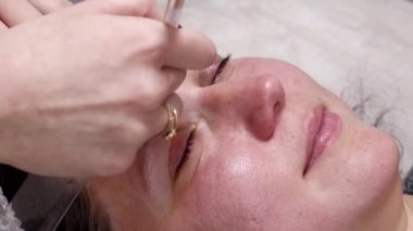 A woman is preparing for a laser rejuvenation procedure in the salon. A cosmetologist-dermatologist completes the photorejuvenation procedure. Shooting is from different angles