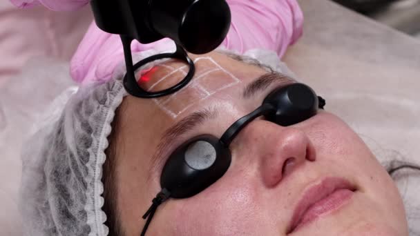 Uma Mulher Está Preparando Para Procedimento Rejuvenescimento Laser Salão Cosmetologista — Vídeo de Stock