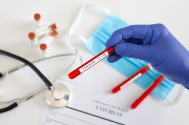 Coronavirus kan testi konsepti. Doktorun elinde tıbbi bir eldiven var. Laboratuvar masasında üzerinde pozitif koronavirüs kanı bulunan bir tüp tutuyor. Coronavirus COVID-19. Salgın.