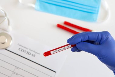 Coronavirus kan testi konsepti. Doktorun elinde tıbbi bir eldiven var. Laboratuvar masasında üzerinde pozitif koronavirüs kanı bulunan bir tüp tutuyor. Coronavirus COVID-19. Salgın.