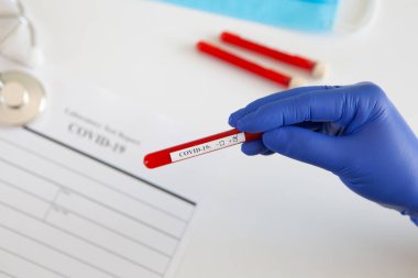 Coronavirus kan testi konsepti. Doktorun elinde tıbbi bir eldiven var. Laboratuvar masasında üzerinde pozitif koronavirüs kanı bulunan bir tüp tutuyor. Coronavirus COVID-19. Salgın.