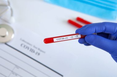 Coronavirus kan testi konsepti. Doktorun elinde tıbbi bir eldiven var. Laboratuvar masasında üzerinde pozitif koronavirüs kanı bulunan bir tüp tutuyor. Coronavirus COVID-19. Salgın.