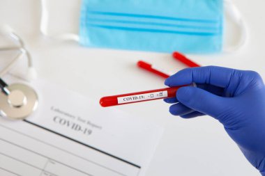 Coronavirus kan testi konsepti. Doktorun elinde tıbbi bir eldiven var. Laboratuvar masasında üzerinde pozitif koronavirüs kanı bulunan bir tüp tutuyor. Coronavirus COVID-19. Salgın.