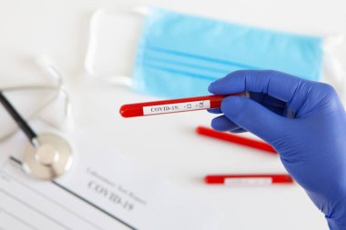 Coronavirus kan testi konsepti. Doktorun elinde tıbbi bir eldiven var. Laboratuvar masasında üzerinde pozitif koronavirüs kanı bulunan bir tüp tutuyor. Coronavirus COVID-19. Salgın.