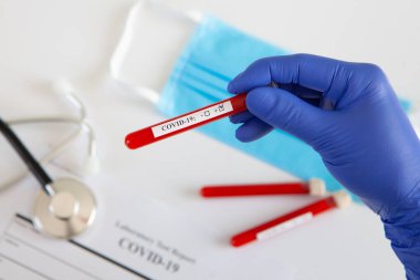 Coronavirus kan testi konsepti. Doktorun elinde tıbbi bir eldiven var. Laboratuvar masasında üzerinde pozitif koronavirüs kanı bulunan bir tüp tutuyor. Coronavirus COVID-19. Salgın.