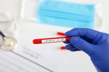 Coronavirus kan testi konsepti. Doktorun elinde tıbbi bir eldiven var. Laboratuvar masasında üzerinde pozitif koronavirüs kanı bulunan bir tüp tutuyor. Coronavirus COVID-19. Salgın.