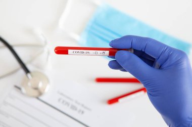 Coronavirus kan testi konsepti. Doktorun elinde tıbbi bir eldiven var. Laboratuvar masasında üzerinde pozitif koronavirüs kanı bulunan bir tüp tutuyor. Coronavirus COVID-19. Salgın.