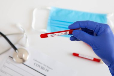 Coronavirus kan testi konsepti. Doktorun elinde tıbbi bir eldiven var. Laboratuvar masasında üzerinde pozitif koronavirüs kanı bulunan bir tüp tutuyor. Coronavirus COVID-19. Salgın.