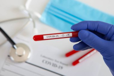Coronavirus kan testi konsepti. Doktorun elinde tıbbi bir eldiven var. Laboratuvar masasında üzerinde pozitif koronavirüs kanı bulunan bir tüp tutuyor. Coronavirus COVID-19. Salgın.