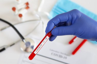 Coronavirus kan testi konsepti. Doktorun elinde tıbbi bir eldiven var. Laboratuvar masasında üzerinde pozitif koronavirüs kanı bulunan bir tüp tutuyor. Coronavirus COVID-19. Salgın.