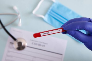 Coronavirus kan testi konsepti. Doktorun elinde tıbbi bir eldiven var. Laboratuvar masasında üzerinde pozitif koronavirüs kanı bulunan bir tüp tutuyor. Coronavirus COVID-19. Salgın.