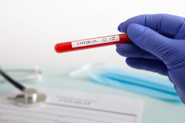 Coronavirus kan testi konsepti. Doktorun elinde tıbbi bir eldiven var. Laboratuvar masasında üzerinde pozitif koronavirüs kanı bulunan bir tüp tutuyor. Coronavirus COVID-19. Salgın.