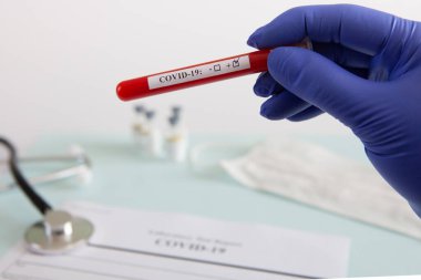 Coronavirus kan testi konsepti. Doktorun elinde tıbbi bir eldiven var. Laboratuvar masasında üzerinde pozitif koronavirüs kanı bulunan bir tüp tutuyor. Coronavirus COVID-19. Salgın.