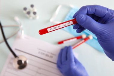 Coronavirus kan testi konsepti. Doktorun elinde tıbbi bir eldiven var. Laboratuvar masasında üzerinde pozitif koronavirüs kanı bulunan bir tüp tutuyor. Coronavirus COVID-19. Salgın.