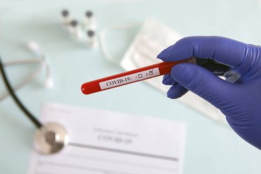 Coronavirus kan testi konsepti. Doktorun elinde tıbbi bir eldiven var. Laboratuvar masasında üzerinde pozitif koronavirüs kanı bulunan bir tüp tutuyor. Coronavirus COVID-19. Salgın.