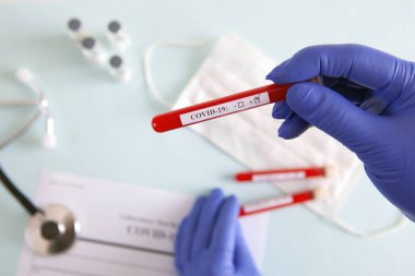 Coronavirus kan testi konsepti. Doktorun elinde tıbbi bir eldiven var. Laboratuvar masasında üzerinde pozitif koronavirüs kanı bulunan bir tüp tutuyor. Coronavirus COVID-19. Salgın.