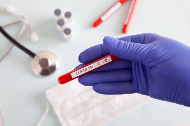 Coronavirus kan testi konsepti. Doktorun elinde tıbbi bir eldiven var. Laboratuvar masasında üzerinde pozitif koronavirüs kanı bulunan bir tüp tutuyor. Coronavirus COVID-19. Salgın.