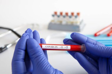 Coronavirus kan testi konsepti. Doktorun elinde tıbbi bir eldiven var. Laboratuvar masasında üzerinde pozitif koronavirüs kanı bulunan bir tüp tutuyor. Coronavirus COVID-19. Salgın.