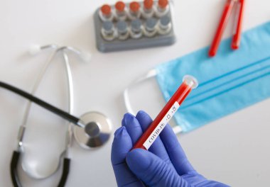 Coronavirus kan testi konsepti. Doktorun elinde tıbbi bir eldiven var. Laboratuvar masasında üzerinde pozitif koronavirüs kanı bulunan bir tüp tutuyor. Coronavirus COVID-19. Salgın.