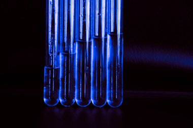 Siyah arka plandaki cam kimya laboratuarı ekipmanlarının analizi için farklı bir laboratuvar cam ve sıvıyla ayarlandı. Kimya Laboratuarı konsepti