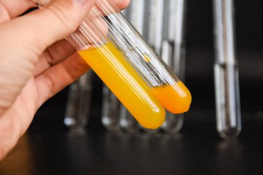 Siyah arka plandaki cam kimya laboratuarı ekipmanlarının analizi için farklı bir laboratuvar cam ve sıvıyla ayarlandı. Kimya Laboratuarı konsepti