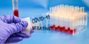 Mikrobiyologların eline eldiven takıp Coronavirus için negatif kan tahlili yapın. Kovid-19 virüsü için kan örneği içeren test tüpleri. Mavi arka planda, Coronavirus kan analizi konsepti. Covid 19 orijinati.