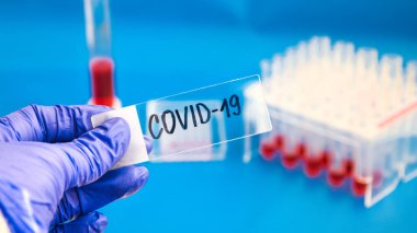 Coronavirus Kan Numunesi, laboratuvar ve kan örneği toplama tüplerindeki kanın DNA testi ve DNA modern arayüzlü şırınga, covid-19 virüsü.