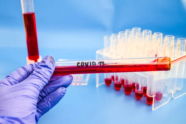 Coronavirus Muestra Sangre Análisis Adn Sangre Laboratorio Tubos Extracción Muestras —  Fotos de Stock