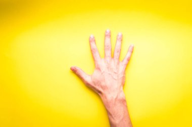 Beyaz Adam 'ın Sağ Kolu Sarı Arkaplanda