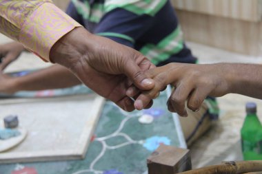 Taş işçiliği nedeniyle bozuk Parmaklar