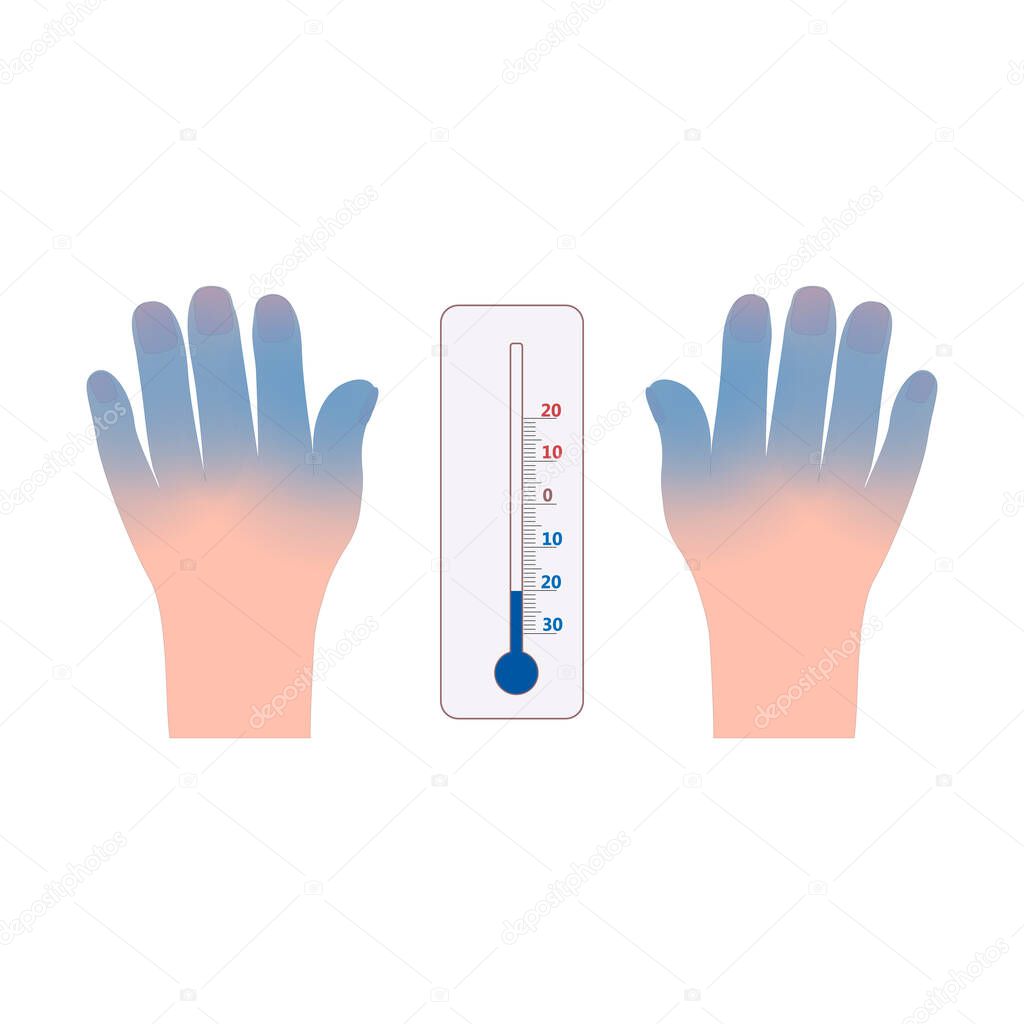 Frostbite hands and thermometer icon vector
