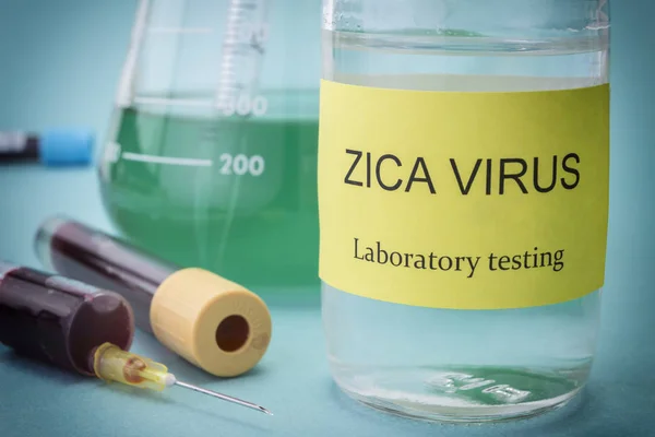 Testes para pesquisa de malária, ebola, urina e tétano — Fotografia de Stock