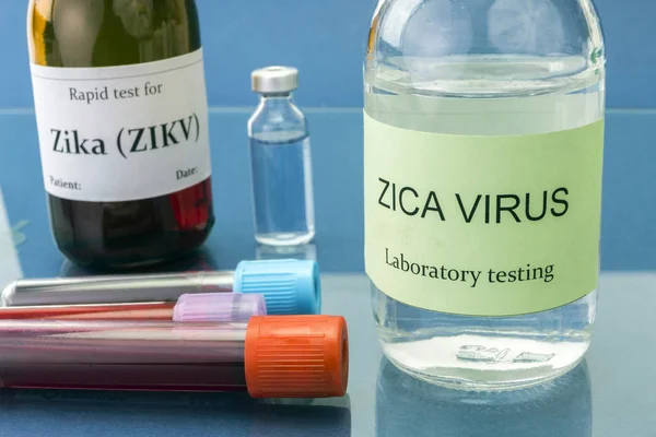 Pruebas para la investigación del virus del Zika — Foto de Stock