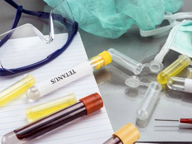 Örnek bir klinik laboratuvar bulaşıcı hastalıkların bazı şişeleri