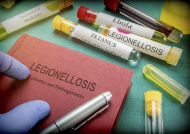 Doktor tutar kitap üzerinde legionellosis içinde A hastane