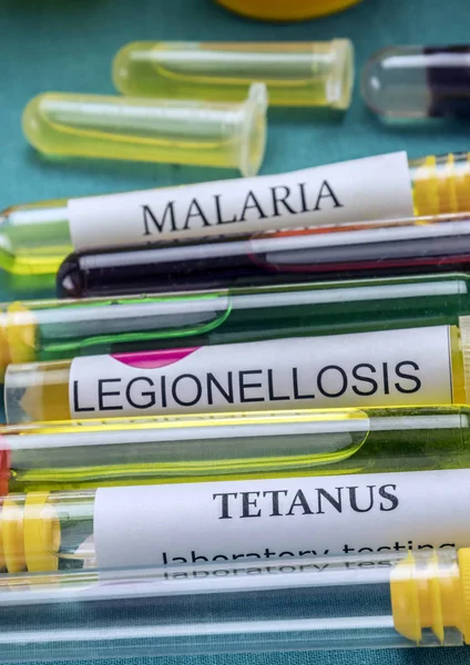 Některé lahviček se vzorky nakažlivých chorob v klinické laboratoři — Stock fotografie