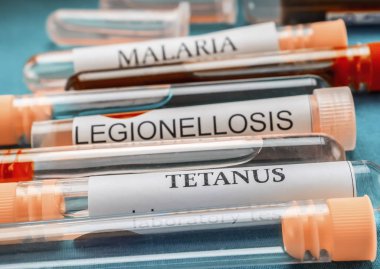 Örnek bir klinik laboratuvar bulaşıcı hastalıkların bazı şişeleri