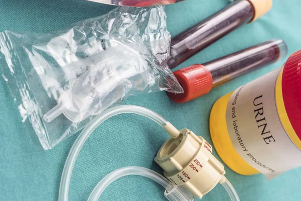 Amostras de urina e sangue em uma tabela hospitalar, imagem conceitual — Fotografia de Stock