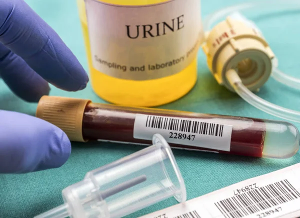 El médico sostiene la muestra de sangre en una mesa del hospital, imagen conceptual — Foto de Stock