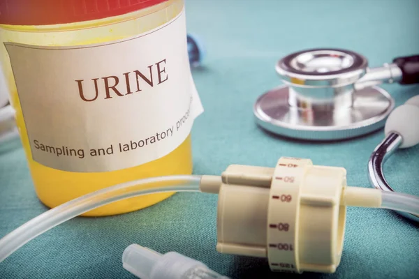 Disque o fluxo ao lado de uma amostra de urina em uma mesa do hospital, conceitual — Fotografia de Stock