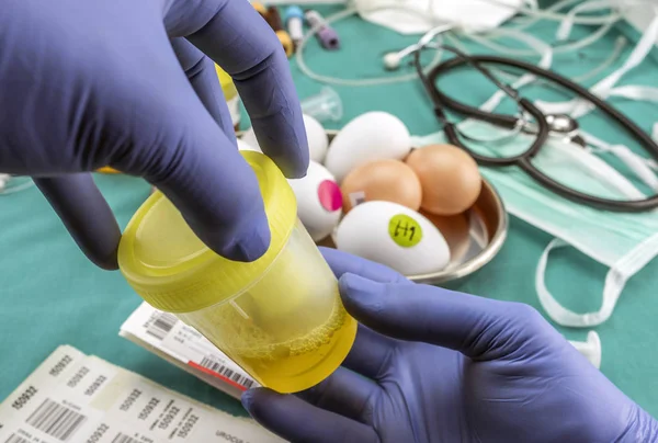 Medico che lavora con campioni di urina in un laboratorio clinico — Foto Stock