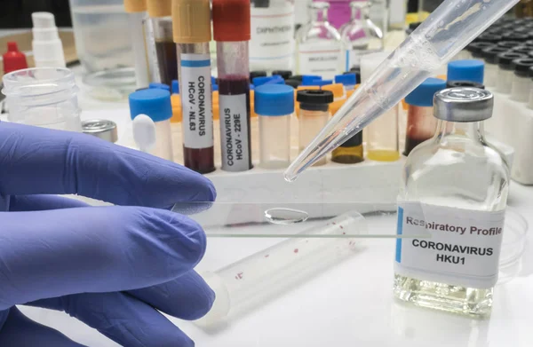 Scientist examines sample of coronavirus in laboratory, conceptual image — Stock Photo, Image