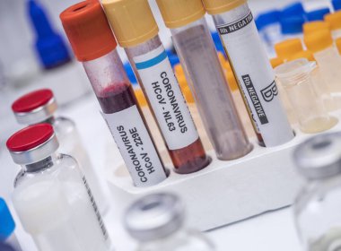 Laboratuvarda koronavirüs örneği, konsept resim