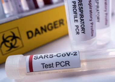 Vial pcr de SarsCov2 koronavirüs, kavramsal görüntü