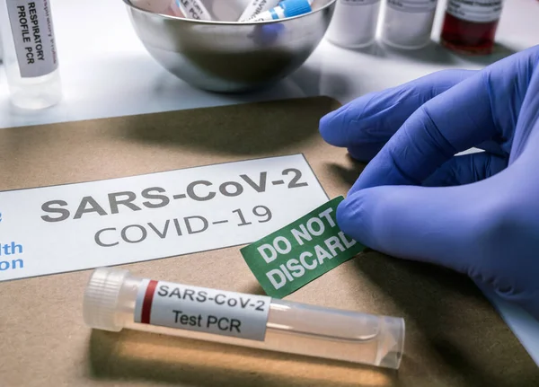 Sarscov2 Coronavirus Pcr Vial Разом Текою Досьє Вказує Слід Відкидати — стокове фото