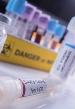 Vial pcr de SarsCov2 koronavirüs, kavramsal görüntü
