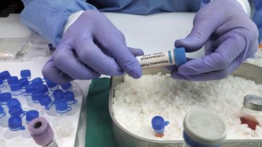 Laboratuvar teknisyeni, Coronavirus örneklerini soğutarak bir hastanede analiz için destekliyor.