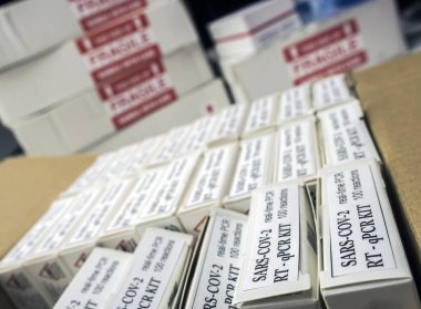 Roman Coronavirus 2019 nCoV PCR tanı kiti. Bu RT-PCR kiti 2019-nCoV ya da virüsün klinik örneklerdeki varlığını tespit etmek için, kavramsal görüntü