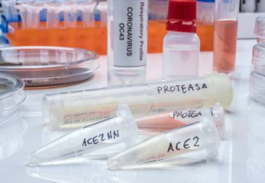 Coronavirus akut solunum sendromunun (SARS) akut solunum sendromunun (SARS) etkinleştirilmesi için çözünür proteinli birkaç şişe İspanya 'da bir hastanede insan solunum yolundaki tripsin benzeri protein