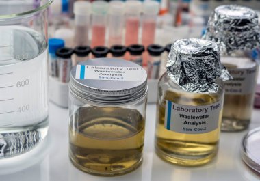 Atık su örnekleri, insan koronavirüsü 229E tarafından enfekte edilen hastalarda sars-cov-2 virüsünün analizi, kavramsal görüntü